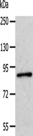 Gel: 10%SDS-PAGE, Lysate: 40 μg, Lane: A172 cells, Primary antibody: APPL1 Antibody(APPL1 Antibody) at dilution 1/600, Secondary antibody: Goat anti rabbit IgG at 1/8000 dilution, Exposure time: 40 secondsRabbit anti-Human APPL1 Polyclonal Antibody