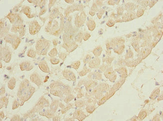 Immunohistochemistry of paraffin-embedded human heart tissue using GALNT2 Antibody at dilution of 1:100Rabbit anti-Human GALNT2 Polyclonal Antibody