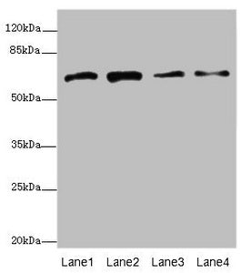 Western blot  | All lanes: GALNT2 antibody at 4.38µg/ml  | Lane 1: Hela whole cell lysate  | Lane 2: Jurkat whole cell lysate  | Lane 3: HepG2 whole cell lysate  | Lane 4: A431 whole cell lysate  | Secondary  | Goat polyclonal to rabbit IgG at 1/10000 dilution  | Predicted band size: 65, 31 kDa  | Observed band size: 65 kDaRabbit anti-Human GALNT2 Polyclonal Antibody