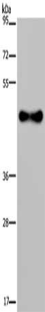 Gel: 8%SDS-PAGE, Lysate: 40 μg, Lane: Human fetal brain tissue, Primary antibody: FADS1 Antibody(FADS1 Antibody) at dilution 1/300, Secondary antibody: Goat anti rabbit IgG at 1/8000 dilution, Exposure time: 10 secondsRabbit anti-Human FADS1 Polyclonal Antibody