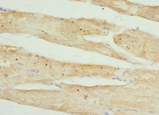 Immunohistochemistry of paraffin-embedded human skeletal muscle tissue using TMOD4 Antibody at dilution of 1:100Rabbit anti-Human TMOD4 Polyclonal Antibody