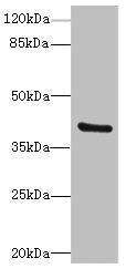 Western blot | All lanes: TMOD4antibody at 4.85μg/ml + Mouse muscle tissue | Secondary | Goat polyclonal to rabbit IgG at 1/10000 dilution | Predicted band size: 40, 32 kDa | Observed band size: 40 kDaRabbit anti-Human TMOD4 Polyclonal Antibody