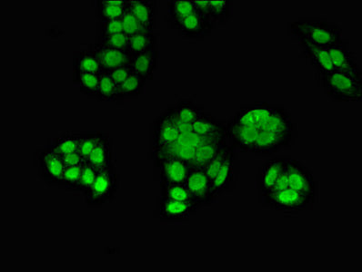Immunofluorescent analysis of PC-3 cells using ZNF816 Antibody at dilution of 1:100 and Alexa Fluor 488-congugated AffiniPure Goat Anti-Rabbit IgG(H+L)Rabbit anti-Human ZNF816 Polyclonal Antibody