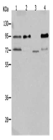 Gel: 10%SDS-PAGE, Lysate: 40 μg, Lane: 293T cells, Primary antibody: AKAP8L Antibody(AKAP8L Antibody) at dilution 1/400, Secondary antibody: Goat anti rabbit IgG at 1/8000 dilution, Exposure time: 50 secondsRabbit anti-Human AKAP8L Polyclonal Antibody