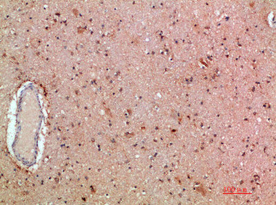 Immunohistochemical analysis of paraffin-embedded human-brain, antibody was diluted at 1:200