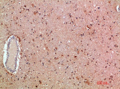 Immunohistochemical analysis of paraffin-embedded human-brain, antibody was diluted at 1:200