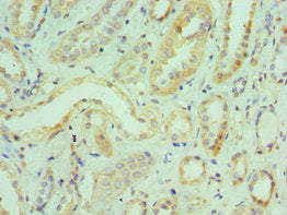 Immunohistochemistry of paraffin-embedded human kidney tissue using ILF3 Antibody at dilution of 1:100Rabbit anti-Human ILF3 Polyclonal Antibody