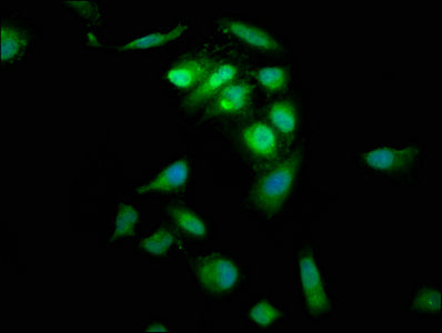 Immunofluorescence staining of Hela cells with PTP4A2 Antibody at 1:66, counter-stained with DAPI. The cells were fixed in 4% formaldehyde, permeabilized using 0.2% Triton X-100 and blocked in 10% normal Goat Serum. The cells were then incubated with the antibody overnight at 4°C. The secondary antibody was Alexa Fluor 488-congugated AffiniPure Goat Anti-Rabbit IgG(H+L).Rabbit anti-Human PTP4A2 Polyclonal Antibody