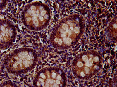 IHC image of PTP4A2 Antibody diluted at 1:200 and staining in paraffin-embedded human appendix tissue performed on a Leica BondTM system. After dewaxing and hydration, antigen retrieval was mediated by high pressure in a citrate buffer (pH 6.0). Section was blocked with 10% normal goat serum 30min at RT. Then primary antibody (1% BSA) was incubated at 4°C overnight. The primary is detected by a biotinylated secondary antibody and visualized using an HRP conjugated SP system.Rabbit anti-Human PTP4A2 Polyclonal Antibody