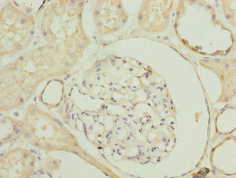 Immunohistochemistry of paraffin-embedded human kidney tissue using SLA Antibody at dilution of 1:100Rabbit anti-Human SLA Polyclonal Antibody