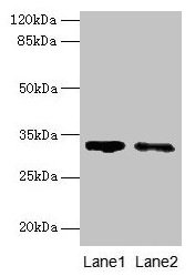 Western blot  | All lanes: SLA antibody at 5µg/ml  | Lane 1: 293T whole cell lysate  | Lane 2: A431 whole cell lysate  | Secondary  | Goat polyclonal to rabbit IgG at 1/10000 dilution  | Predicted band size: 32, 20, 34, 28, 36 kDa  | Observed band size: 32 kDaRabbit anti-Human SLA Polyclonal Antibody