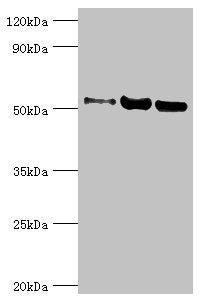 Western blot | All lanes: Carbonic anhydrase 1 antibody at 2μg/ml | Lane 1: HepG2 whole cell lysate | Lane 2: 293T whole cell lysate | Lane 3: 293T whole cell lysate | Secondary | Goat polyclonal to rabbit IgG at 1/10000 dilution | Predicted band size: 53, 14 kDa | Observed band size: 53 kDaRabbit anti-Human G3BP1 Polyclonal Antibody