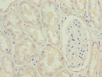 Immunohistochemistry of paraffin-embedded human kidney tissue using MRPL49 Antibody at dilution of 1:100