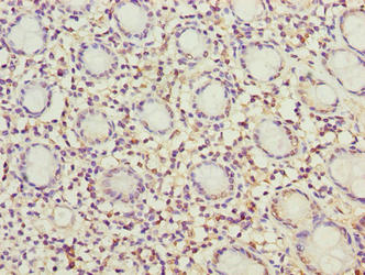 Immunohistochemistry of paraffin-embedded human colon tissue using MRPL49 Antibody at dilution of 1:100