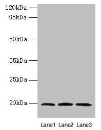 Western blot  | All lanes: MRPL49 antibody at 0.6µg/ml  | Lane 1: Colo320 whole cell lysate  | Lane 2: Mouse liver tissue  | Lane 3: Mouse kidney tissue  | Secondary  | Goat polyclonal to rabbit IgG at 1/10000 dilution  | Predicted band size: 20 kDa  | Observed band size: 20 kDa