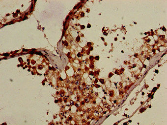 Immunohistochemistry of paraffin-embedded human testis tissue using OS9 Antibody at dilution of 1:100Rabbit anti-Human OS9 Polyclonal Antibody