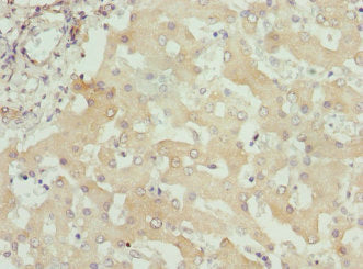 Immunohistochemistry of paraffin-embedded human liver tissue using ITPK1 Antibody at dilution of 1:100