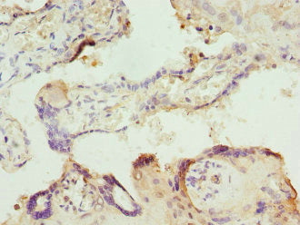 Immunohistochemistry of paraffin-embedded human placenta tissue using ITPK1 Antibody at dilution of 1:100