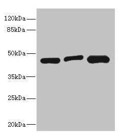 Western blot  | All lanes: ITPK1 antibody at 3.58µg/ml  | Lane 1: Hela whole cell lysate  | Lane 2: HepG2 whole cell lysate  | Lane 3: A431 whole cell lysate  | Secondary  | Goat polyclonal to rabbit IgG at 1/10000 dilution  | Predicted band size: 46, 36 kDa  | Observed band size: 46 kDa