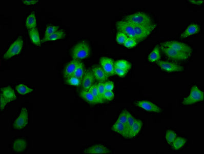 Immunofluorescence staining of HepG2 cells with SEMA5A Antibody at 1:400, counter-stained with DAPI. The cells were fixed in 4% formaldehyde, permeabilized using 0.2% Triton X-100 and blocked in 10% normal Goat Serum. The cells were then incubated with the antibody overnight at 4°C. The secondary antibody was Alexa Fluor 488-congugated AffiniPure Goat Anti-Rabbit IgG(H+L).Rabbit anti-Human SEMA5A Polyclonal Antibody