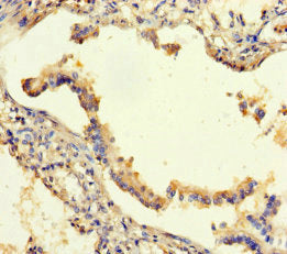 Immunohistochemistry of paraffin-embedded human lung tissue using the antibody at dilution of 1:100Rabbit anti-Human SEMA5A Polyclonal Antibody