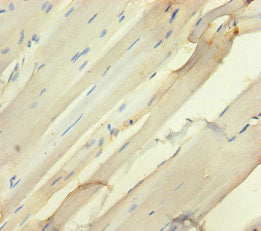 Immunohistochemistry of paraffin-embedded human skeletal muscle tissue using SEMA5A Antibody at dilution of 1:100Rabbit anti-Human SEMA5A Polyclonal Antibody