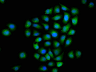 Immunofluorescence staining of Hela cells with MTMR2 Antibody at 1:133, counter-stained with DAPI. The cells were fixed in 4% formaldehyde, permeabilized using 0.2% Triton X-100 and blocked in 10% normal Goat Serum. The cells were then incubated with the antibody overnight at 4°C. The secondary antibody was Alexa Fluor 488-congugated AffiniPure Goat Anti-Rabbit IgG(H+L).Rabbit anti-Human MTMR2 Polyclonal Antibody