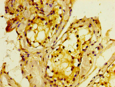 IHC image of MTMR2 Antibody diluted at 1:400 and staining in paraffin-embedded human testis tissue performed on a Leica BondTM system. After dewaxing and hydration, antigen retrieval was mediated by high pressure in a citrate buffer (pH 6.0). Section was blocked with 10% normal goat serum 30min at RT. Then primary antibody (1% BSA) was incubated at 4°C overnight. The primary is detected by a biotinylated secondary antibody and visualized using an HRP conjugated SP system.Rabbit anti-Human MTMR2 Polyclonal Antibody
