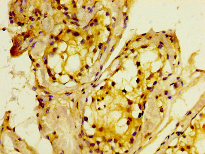 IHC image of MTMR2 Antibody diluted at 1:400 and staining in paraffin-embedded human testis tissue performed on a Leica BondTM system. After dewaxing and hydration, antigen retrieval was mediated by high pressure in a citrate buffer (pH 6.0). Section was blocked with 10% normal goat serum 30min at RT. Then primary antibody (1% BSA) was incubated at 4°C overnight. The primary is detected by a biotinylated secondary antibody and visualized using an HRP conjugated SP system.Rabbit anti-Human MTMR2 Polyclonal Antibody