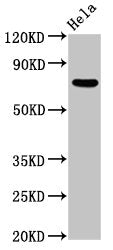 Western Blot | Positive WB detected in: Hela whole cell lysate | All lanes: MTMR2 antibody at 5.5μg/ml | Secondary | Goat polyclonal to rabbit IgG at 1/50000 dilution | Predicted band size: 74, 66 kDa | Observed band size: 74 kDaRabbit anti-Human MTMR2 Polyclonal Antibody