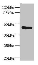 Western blot | All lanes: BAAT antibody IgG at 3.73μg/ml + Mouse liver tissue | Secondary | Goat polyclonal to rabbit IgG at 1/10000 dilution | Predicted band size: 46 kDa | Observed band size: 46 kDa