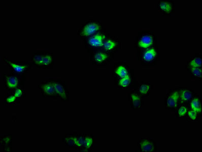 Immunofluorescence staining of PC-3 cells with the antibody at 1:166, counter-stained with DAPI. The cells were fixed in 4% formaldehyde, permeabilized using 0.2% Triton X-100 and blocked in 10% normal Goat Serum. The cells were then incubated with the antibody overnight at 4°C. The secondary antibody was Alexa Fluor 488-congugated AffiniPure Goat Anti-Rabbit IgG(H+L).Rabbit anti-Human RAB33A Polyclonal Antibody