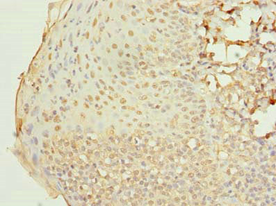 Immunohistochemistry of paraffin-embedded human tonsil tissue using RAB33A Antibody at dilution of 1:100Rabbit anti-Human RAB33A Polyclonal Antibody