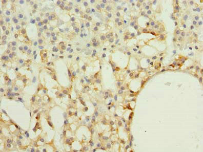 Immunohistochemistry of paraffin-embedded human adrenal gland tissue using RAB33A Antibody at dilution of 1:100Rabbit anti-Human RAB33A Polyclonal Antibody