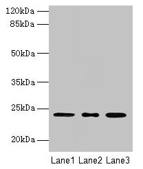 Western blot  | All lanes: MRPL58 antibody at 2µg/ml  | Lane 1: A549 whole cell lysate  | Lane 2: Jurkat whole cell lysate  | Lane 3: K562 whole cell lysate  | Secondary  | Goat polyclonal to rabbit IgG at 1/10000 dilution  | Predicted band size: 24 kDa  | Observed band size: 24 kDa