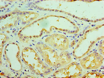 Immunohistochemistry of paraffin-embedded human kidney tissue using GALE Antibody at dilution of 1:100Rabbit anti-Human GALE Polyclonal Antibody