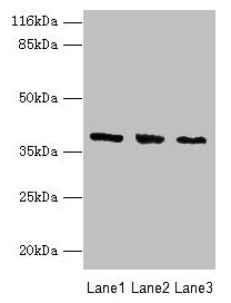 Western blot  | All lanes: GALE antibody at 2µg/ml  | Lane 1: HepG2 whole cell lysate  | Lane 2: Hela whole cell lysate  | Lane 3: A549 whole cell lysate  | Secondary  | Goat polyclonal to rabbit IgG at 1/10000 dilution  | Predicted band size: 39, 31 kDa  | Observed band size: 39 kDaRabbit anti-Human GALE Polyclonal Antibody