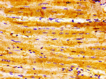IHC image of SEMA3A Antibody diluted at 1:300 and staining in paraffin-embedded human heart tissue performed on a Leica BondTM system. After dewaxing and hydration, antigen retrieval was mediated by high pressure in a citrate buffer (pH 6.0). Section was blocked with 10% normal goat serum 30min at RT. Then primary antibody (1% BSA) was incubated at 4°C overnight. The primary is detected by a biotinylated secondary antibody and visualized using an HRP conjugated SP system.Rabbit anti-Human SEMA3A Polyclonal Antibody