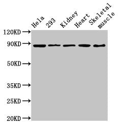 Western Blot  | Positive WB detected in: Hela whole cell lysate, 293 whole cell lysate, Rat kidney tissue, Mouse heart tissue, Mouse skeletal muscle tissue  | All lanes: SEMA3A antibody at 3.6µg/ml  | Secondary  | Goat polyclonal to rabbit IgG at 1/50000 dilution  | Predicted band size: 89 kDa  | Observed band size: 89 kDaRabbit anti-Human SEMA3A Polyclonal Antibody