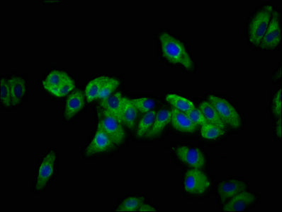 Immunofluorescence staining of HepG2 cells with DSC3 Antibody at 1:133, counter-stained with DAPI. The cells were fixed in 4% formaldehyde, permeabilized using 0.2% Triton X-100 and blocked in 10% normal Goat Serum. The cells were then incubated with the antibody overnight at 4°C. The secondary antibody was Alexa Fluor 488-congugated AffiniPure Goat Anti-Rabbit IgG(H+L).Rabbit anti-Human DSC3 Polyclonal Antibody