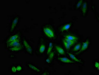 Immunofluorescent analysis of Hela cells using USP10 Antibody at dilution of 1:100 and Alexa Fluor 488-congugated AffiniPure Goat Anti-Rabbit IgG(H+L)Rabbit anti-Human USP10 Polyclonal Antibody