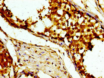 Immunohistochemistry of paraffin-embedded human testis tissue using USP10 Antibody at dilution of 1:100Rabbit anti-Human USP10 Polyclonal Antibody
