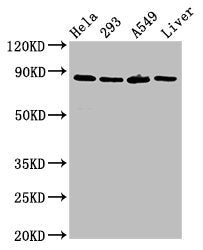 Western Blot | Positive WB detected in: Hela whole cell lysate, 293 whole cell lysate, A549 whole cell lysate, Rat liver tissue | All lanes: USP10 antibody at 3μg/ml | Secondary | Goat polyclonal to rabbit IgG at 1/50000 dilution | Predicted band size: 88, 93 kDa | Observed band size: 88 kDaRabbit anti-Human USP10 Polyclonal Antibody