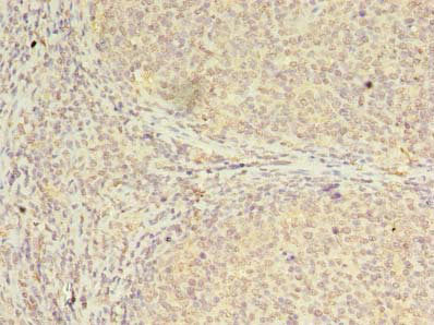 Immunohistochemistry of paraffin-embedded human tonsil tissue using CBX2 Antibody at dilution of 1:100