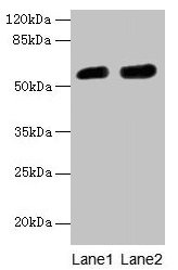 Western blot  | All lanes: CBX2 antibody at 6µg/ml  | Lane 1: A431 whole cell lysate  | Lane 2: Mouse heart tissue  | Secondary  | Goat polyclonal to rabbit IgG at 1/10000 dilution  | Predicted band size: 57, 24 kDa  | Observed band size: 57 kDa