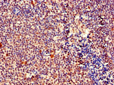 IHC image of MEF2D Antibody diluted at 1:400 and staining in paraffin-embedded human tonsil tissue performed on a Leica BondTM system. After dewaxing and hydration, antigen retrieval was mediated by high pressure in a citrate buffer (pH 6.0). Section was blocked with 10% normal goat serum 30min at RT. Then primary antibody (1% BSA) was incubated at 4°C overnight. The primary is detected by a biotinylated secondary antibody and visualized using an HRP conjugated SP system.