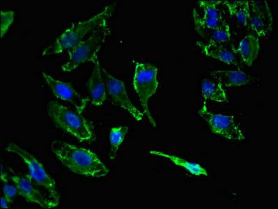 Immunofluorescent analysis of HepG2 cells using KIF14 Antibody at dilution of 1:100 and Alexa Fluor 488-congugated AffiniPure Goat Anti-Rabbit IgG(H+L)