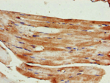 Immunohistochemistry of paraffin-embedded human skeletal muscle tissue using the antibody at dilution of 1:100