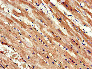 Immunohistochemistry of paraffin-embedded human heart tissue using KIF14 Antibody at dilution of 1:100