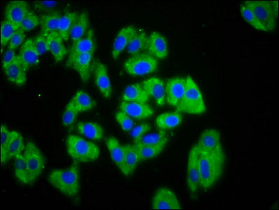 Immunofluorescence staining of HepG2 cells with PTPRK Antibody at 1:133, counter-stained with DAPI. The cells were fixed in 4% formaldehyde, permeabilized using 0.2% Triton X-100 and blocked in 10% normal Goat Serum. The cells were then incubated with the antibody overnight at 4°C. The secondary antibody was Alexa Fluor 488-congugated AffiniPure Goat Anti-Rabbit IgG(H+L).Rabbit anti-Human PTPRK Polyclonal Antibody
